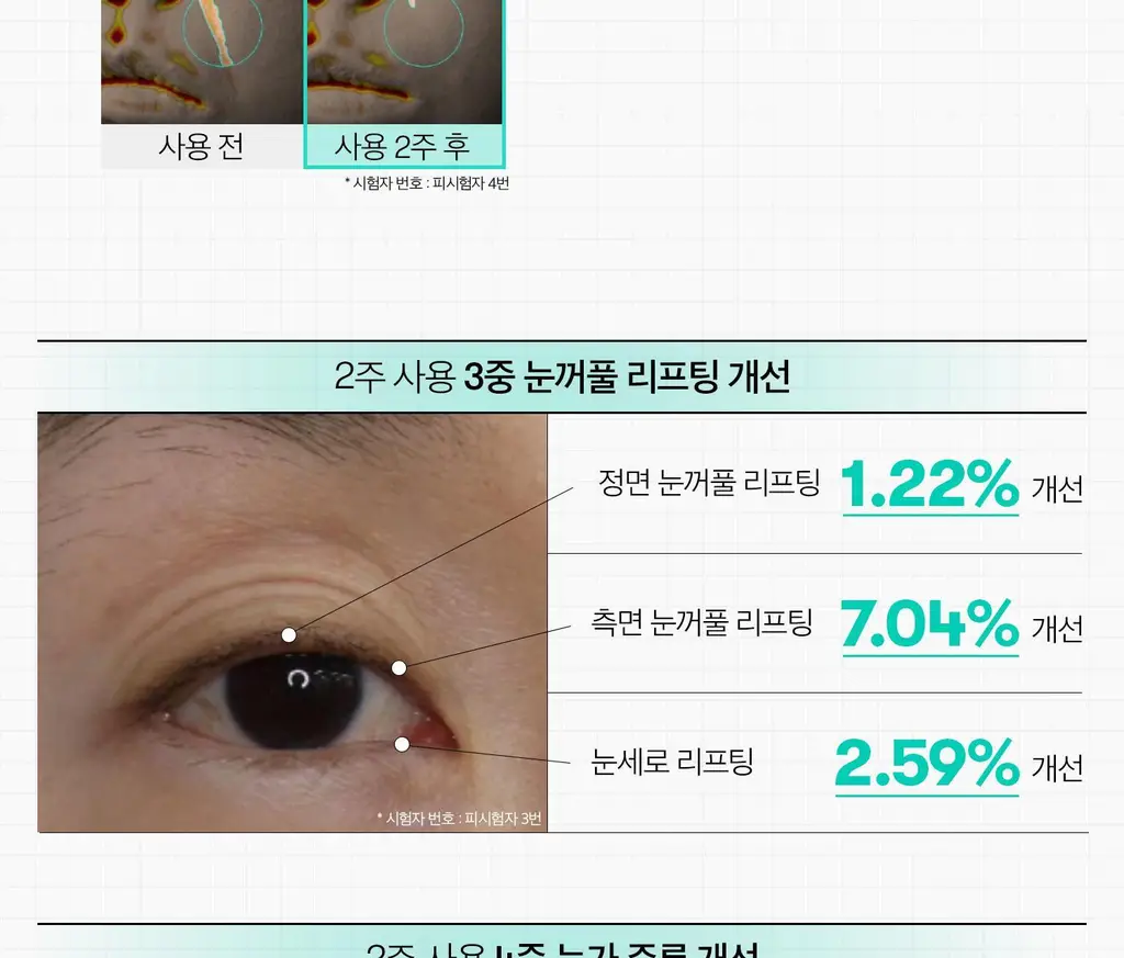 [아이크림/눈가탄력] VT 피디알엔 리들샷 아이 리프터 15ml 상세페이지 22